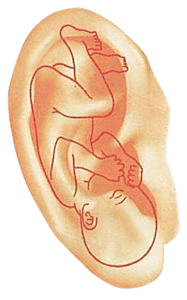 Somatotopía de la oreja en Etioterapia